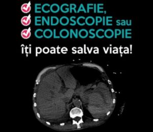 ecografie